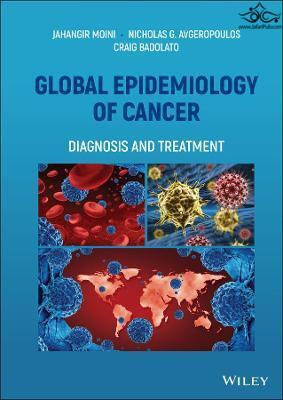 Global Epidemiology of Cancer: Diagnosis and Treatment 1st Edición  John Wiley and Sons Ltd 