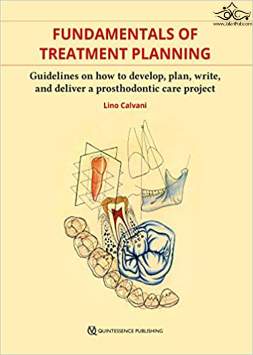 F undamentals of Treatment Planning : Guidelines on How to Develop, Plan, Write, and Deliver a Prosthodontic Care  Quintessence Publishing Co Inc.,U.S