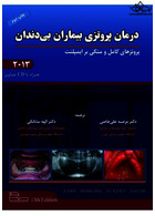 درمان پروتزی بیماران بی دندان زارب 2013