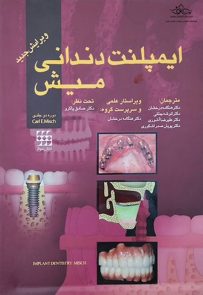 ایمپلنت دندانی میش 1 و 2