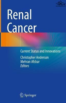 Renal Cancer: Current Status and Innovations Springer