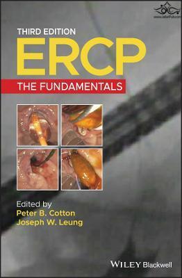 ERCP: The Fundamentals 3rd Edición  John Wiley and Sons Ltd 