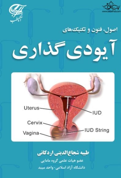 اصول فنون و تکنیک های آیودی گذاری