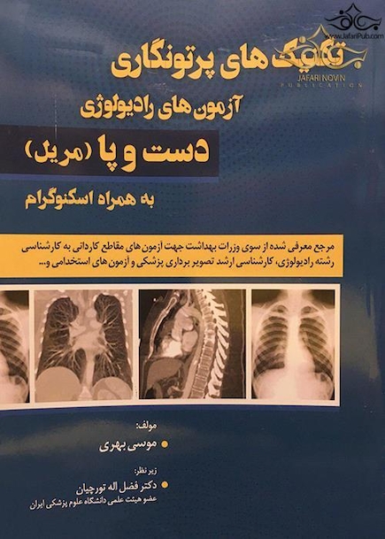 تکنیک های پرتونگاری آزمون های رادیولوژِی دست و پا (مریل) به همراه اسکنوگرام سیاه و سفید
