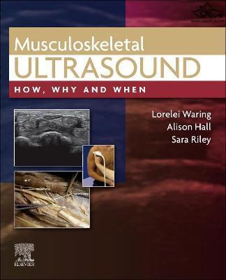 Musculoskeletal Ultrasound: How, Why and When 1st Edición ELSEVIER