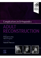 Complications in Orthopaedics: Adult Reconstruction 1st Edición | عوارض ارتوپدی