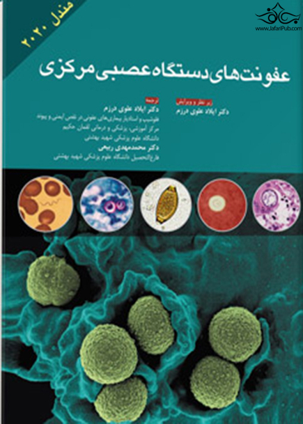 عفونت های دستگاه عصبی مرکزی مندل 2020