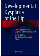 Developmental Dysplasia of the Hip: From Early Sonographic Diagnosis to Effective Treatment | دیسپلازی رشدی هیپ