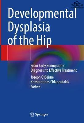 Developmental Dysplasia of the Hip: From Early Sonographic Diagnosis to Effective Treatment Springer