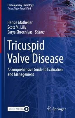 Tricuspid Valve Disease: A Comprehensive Guide to Evaluation and Management (Contemporary Cardiology) 1st ed. 2022 Edition Springer