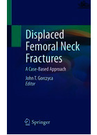 Displaced Femoral Neck Fractures : A Case-Based Approach | شکستگی های جابجا شده گردن فمور
