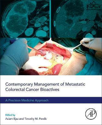 Contemporary Management of Metastatic Colorectal Cancer : A Precision Medicine Approach ELSEVIER
