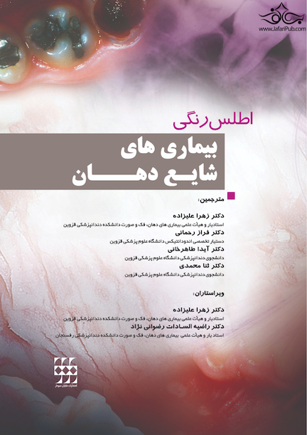 اطلس رنگی بیماری های شایع دهان