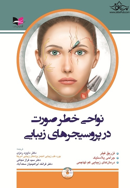 نواحی خطر صورت در پروسیجرهای زیبایی