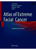 Atlas of Extreme Facial Cancer : Challenges and Solutions | اطلس سرطان شدید صورت