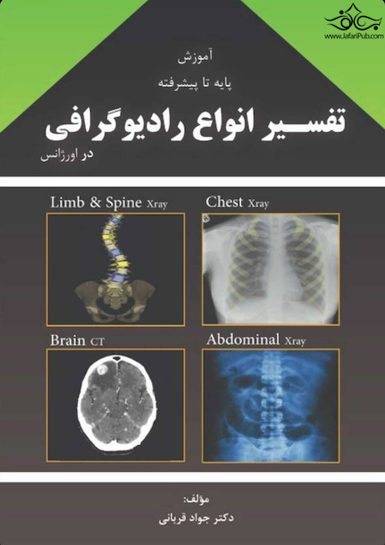 آموزش پایه تا پیشرفته تفسیر انواع رادیوگرافی در اورژانس