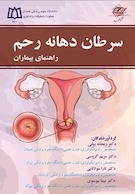 سرطان دهانه رحم