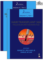 Hair Transplant 360: Follicular Unit Excision 2020 | کاشت مو 360