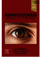 Keratoconus,E-Book: Diagnosis and Management | قوز قرنی،: تشخیص و مدیریت