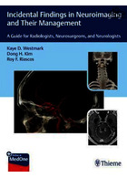 Incidental Findings in Neuroimaging and Their Management: A Guide for Radiologists, Neurosurgeons, and Neurologists | یافته های حادثه ای در تصویربرداری عصبی و مدیریت آنها: راهنمایی برای رادیولوژیست ها ، جراحان مغز و اعصاب و متخصصان مغز و اعصاب