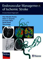 Endovascular Management of Ischemic Stroke : A Case-Based Approach | مدیریت اندوواسکولار سکته مغزی ایسکمیک: یک رویکرد مبتنی بر مورد