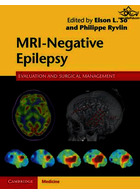 MRI-Negative Epilepsy: Evaluation and Surgical Management | صرع منفی MRI: ارزیابی و مدیریت جراحی