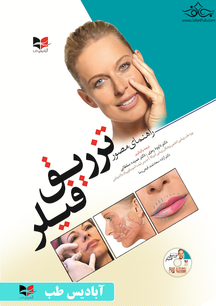 راهنمای مصور تزریق فیلر