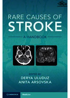 Rare Causes of Stroke: A Handbook | علل نادر سکته: کتابچه راهنمای