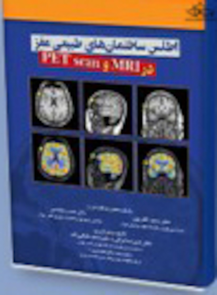اطلس ساختمان ها ی طبیعی مغز در MRI و PET scan