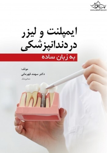 ایمپلنت و لیزر در دندانپزشکی به زبان ساده