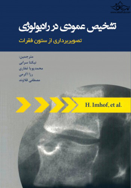 تشخیص عمودی در رادیولوژی با تصویربرداری از ستون فقرات