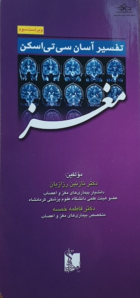 تفسیر آسان سی تی اسکن مغز
