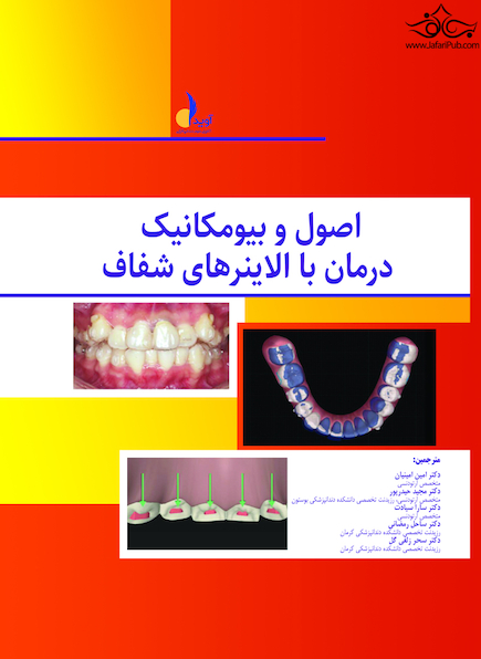 اصول و بیومکانیک درمان با الاینرهای شفاف