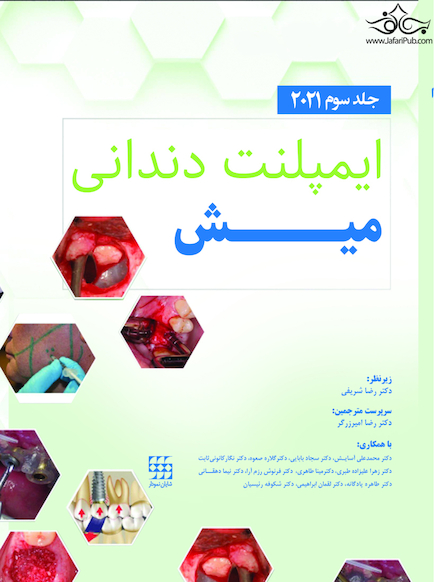 ایمپلنت دندانی میش 2021 جلد سوم