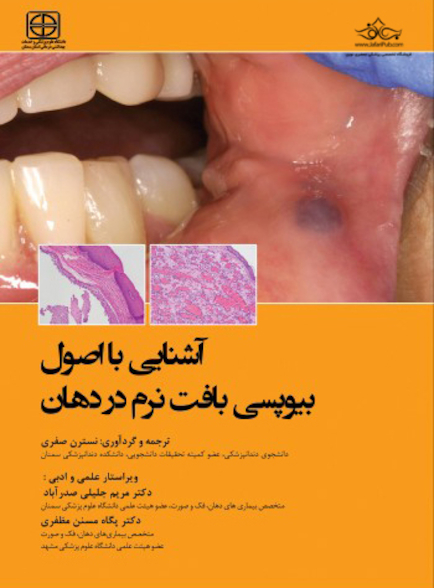 آشنایی با اصول بیوپسی بافت نرم در دهان