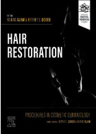 Procedures in Cosmetic Dermatology: Hair Restoration - E-Book Kindle Edition | روش های درماتولوژی زیبایی: ترمیم مو
