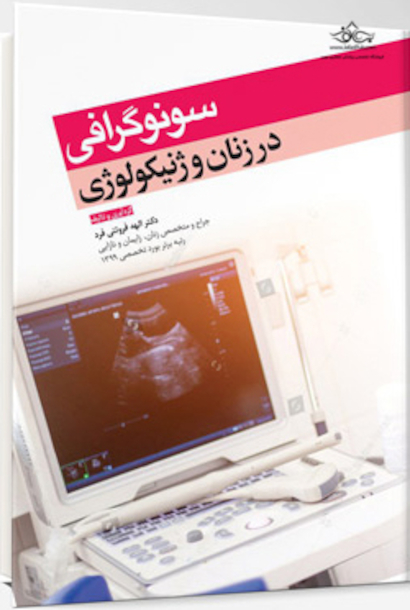 سونوگرافی در زنان و ژنیکولوژی