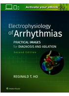 Electrophysiology of Arrhythmias: Practical Images for Diagnosis and Ablation 2nd Edicion 2020 | الکتروفیزیولوژی آریتمی ها: تصاویر عملی برای تشخیص و ابلیشن ویرایش دوم