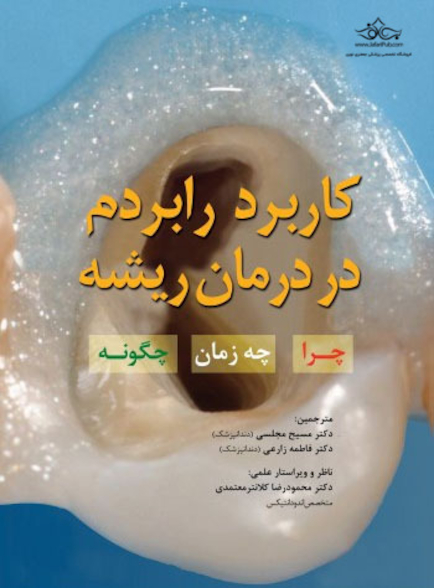 کاربرد رابردم در درمان ریشه چرا چه زمان چگونه