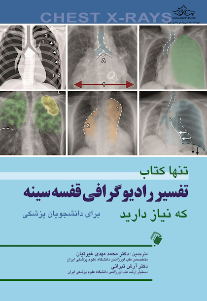 تنها کتاب تفسیر رادیوگرافی قفسه سینه که نیاز دارید