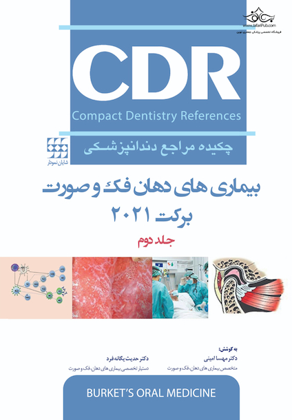 CDR چکیده مراجع دندانپزشکی بیماری های دهان، فک و صورت برکت 2021  جلد دوم