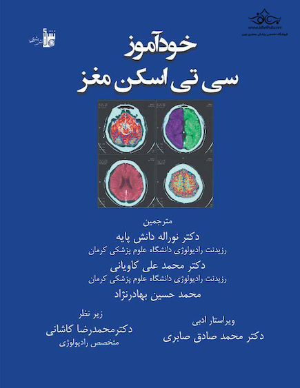 خودآموز سی  تی اسکن مغز