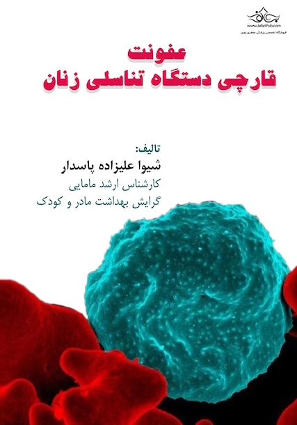 عفونت قارچی دستگاه تناسلی زنان