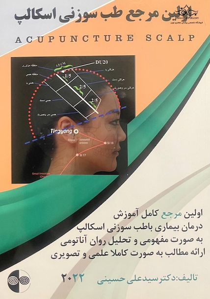 اولین مرجع طب سوزنی اسکالپ 2022