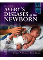 Avery's Diseases of the Newborn 11th Edicion 2021 | بیماری های نوزادان اوری  ویرایش 11