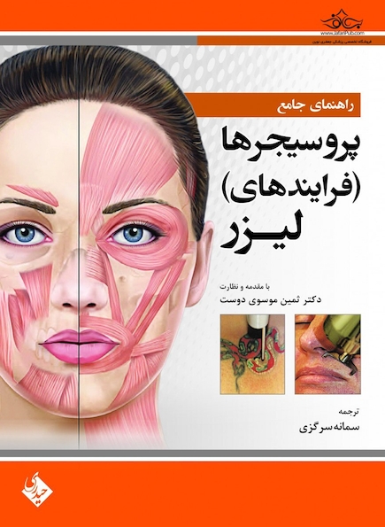 راهنمای جامع پروسیجرها فرایندهای لیزر