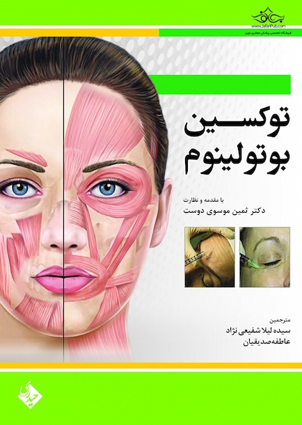 توکسین بوتولینیوم