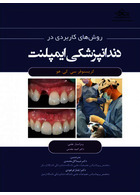روش های کاربردی در دندانپزشکی ایمپلنت 2021