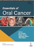 Essentials of Oral Cancer | ملزومات سرطان دهان