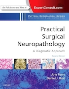 Practical Surgical Neuropathology: A Diagnostic Approach: A Volume in the Pattern Recognition Series 2nd Edition | آسیب شناسی اعصاب جراحی عملی: یک رویکرد تشخیصی: جلدی در سری دوم تشخیص الگو
